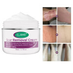 Crema-de-rebote-de-la-piel-sin-cicatrices-crema-facial-para-eliminar-cicatrices-de-acn-estr.webp