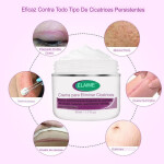 Crema-de-rebote-de-la-piel-sin-cicatrices-crema-facial-para-eliminar-cicatrices-de-acn-estr.webp