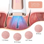 Dispositivo-de-depilacion-para-mujeres-y-hombres-con-gafas-de-sol-y-cuchillos-de-afeitado-actualizacion-a-999.900-destellos-para-piernas-brazos-axilas-cuerpo-uso-domestico-1.jpg